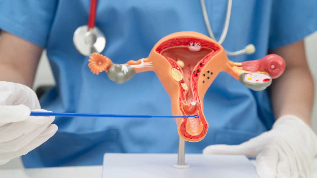 Modello anatomico dell'utero e della cervice, con una persona (che indossa guanti medici) che dimostra la procedura di prelievo citologico (come un Pap test o un prelievo per HPV) utilizzando una piccola spazzola o un dispositivo simile per raccogliere cellule dalla cervice. La persona indossa un'uniforme medica blu con uno stetoscopio intorno al collo
